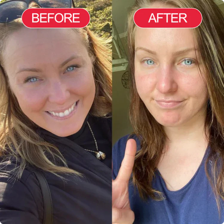 Korean Centella Premium Skincare Set (5 Pcs™)