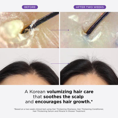Dr.Groot Complete Set to Reduce Hair Loss, Scalp Revitalizing Solution, Hair Thickening, Biotin