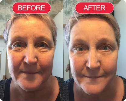 Korean Centella Premium Skincare Set (5 Pcs™)