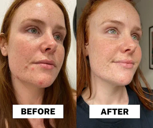 Korean Centella Premium Skincare Set (5 Pcs™)