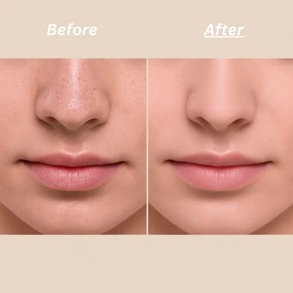Dr Melaxin™ - Korean Peel Shot Exfoliator