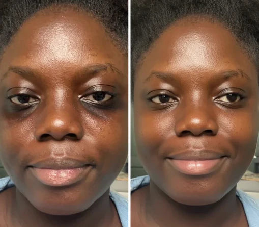 Korean Centella Premium Skincare Set (5 Pcs™)