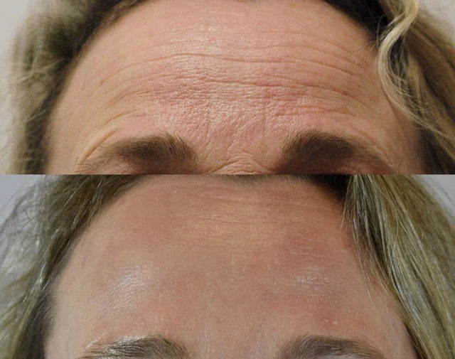 Korean Centella Premium Skincare Set (5 Pcs™)