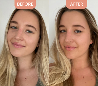 Korean Centella Premium Skincare Set (5 Pcs™)