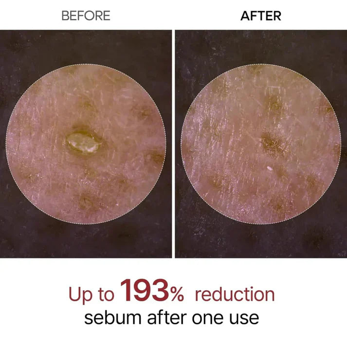 Dr Melaxin™ - Korean Peel Shot Exfoliator