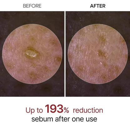 Dr Melaxin™ - Korean Peel Shot Exfoliator
