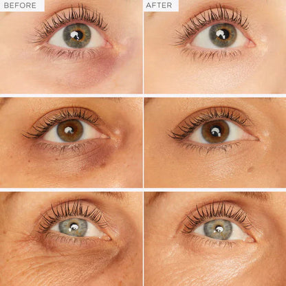 Korean Centella Premium Skincare Set (5 Pcs™)